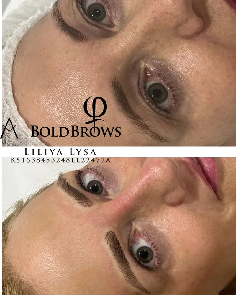 Antes y después de microblading de cejas, clienta 1